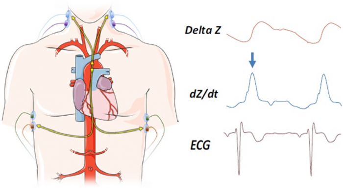 Electrical Impedance Method in Modern Diagnostics